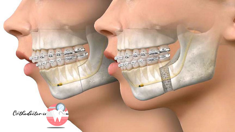 ناهنجاری‌های فکی
